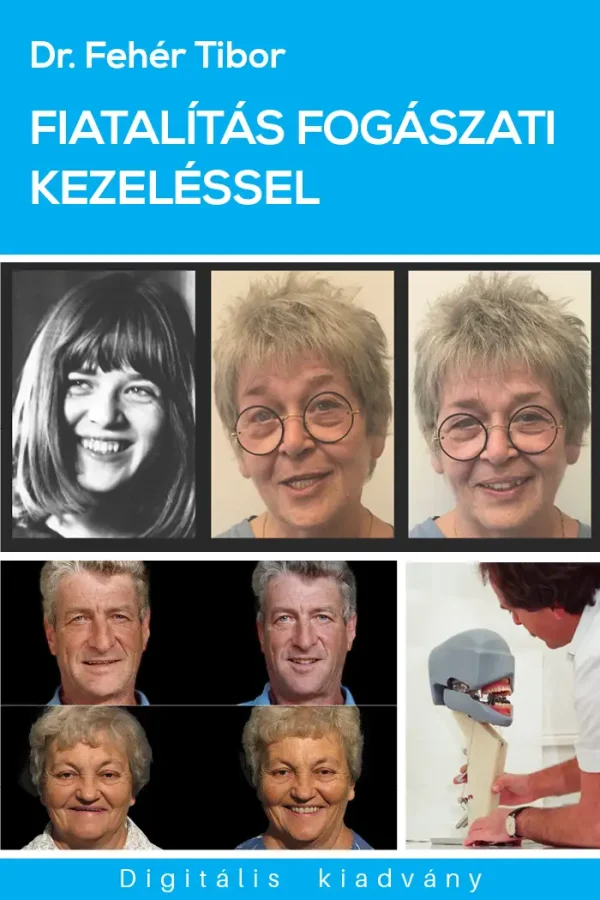 Fiatalítás fogászati kezeléssel