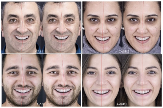 mesterséges intelligencia integrációja
